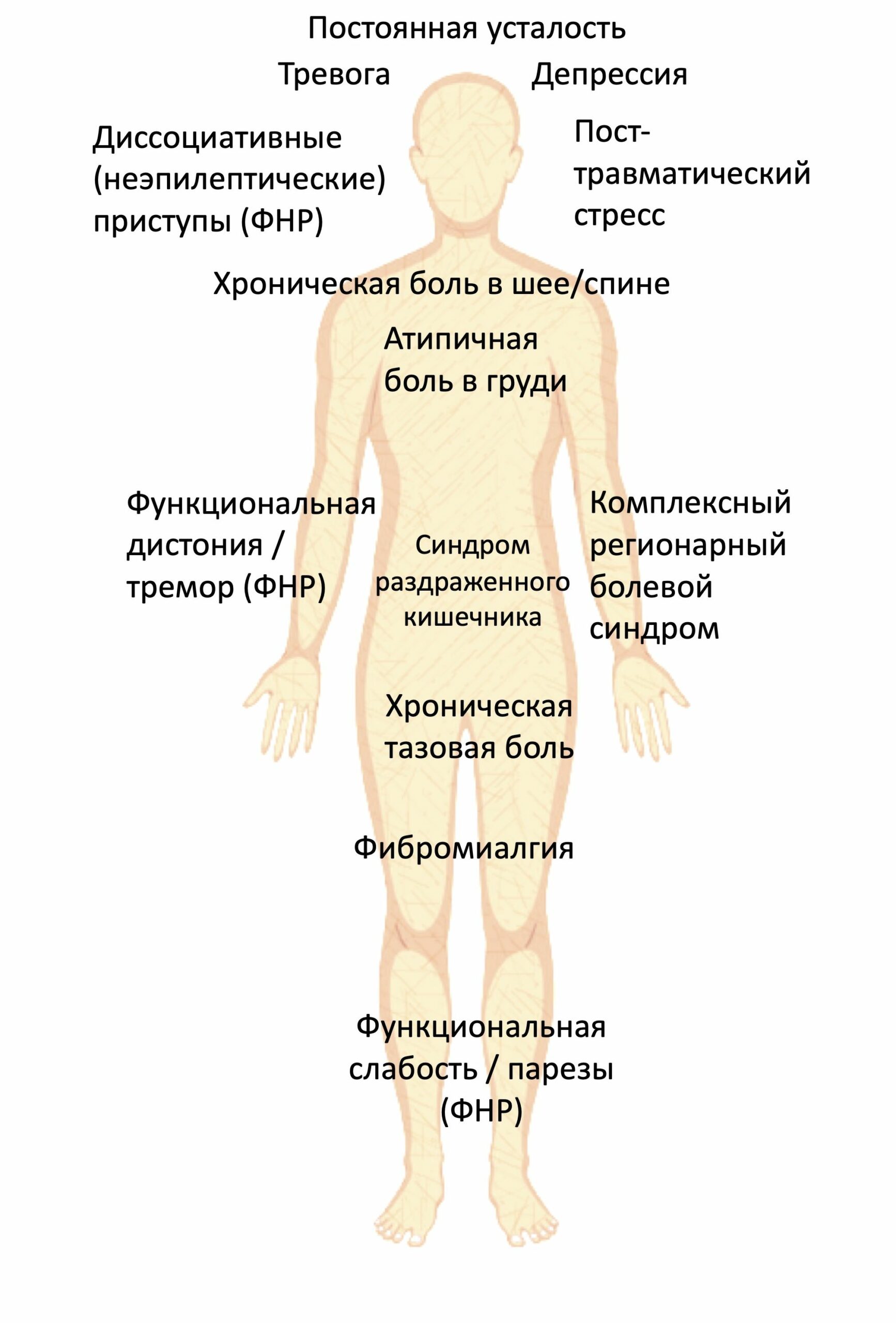 ФНР и другие функциональные расстройства – Functional Neurological Disorder  (FND)